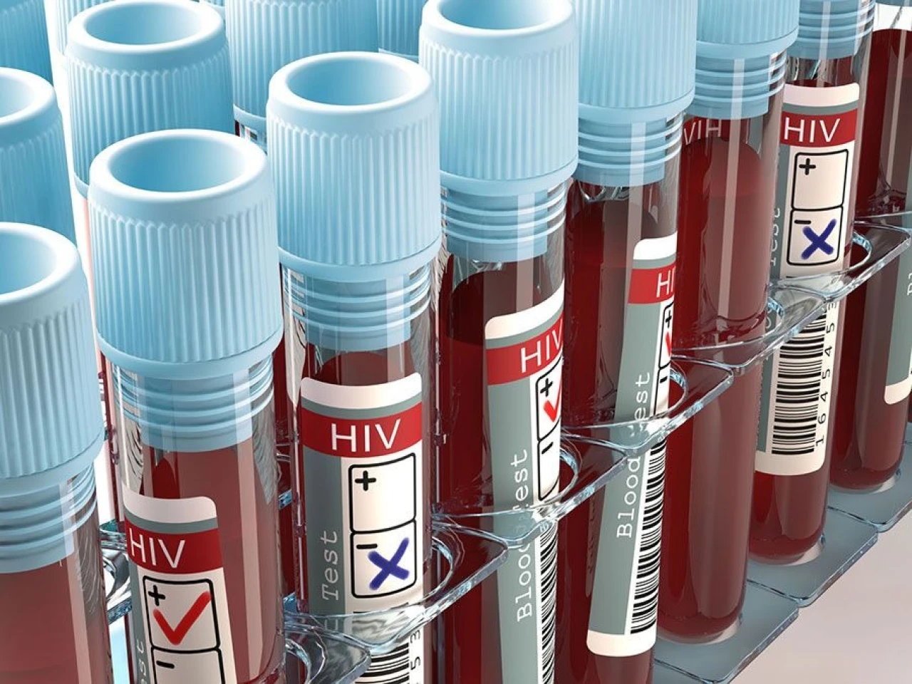 AIDS nedir? HIV virüsü, AIDS belirtileri ve tedavi yöntemleri nelerdir?