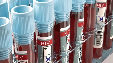 AIDS nedir? HIV virüsü, AIDS belirtileri ve tedavi yöntemleri nelerdir?