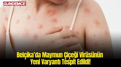 Belçika’da Maymun Çiçeği Virüsünün Yeni Varyantı Tespit Edildi!